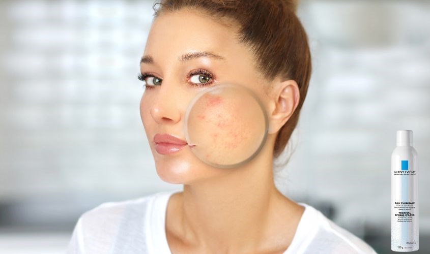 Xịt khoáng làm dịu da và chống oxy hoá La Roche-Posay Eau Thermale 300 ml Xịt khoáng làm dịu da và chống oxy hoá La Roche-Posay Eau Thermale 300 ml