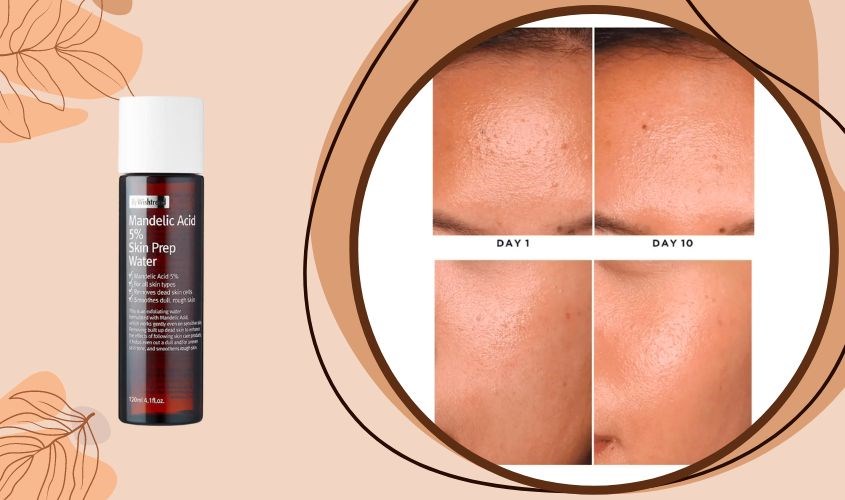 Sản phẩm hoạt động tốt trên bề mặt da, giúp da sáng và đều màu hơn