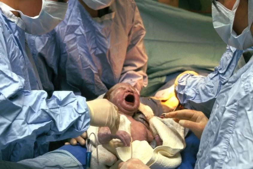 Thai ngôi mông có được sinh thường không