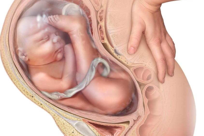 Thai ngôi mông là gì