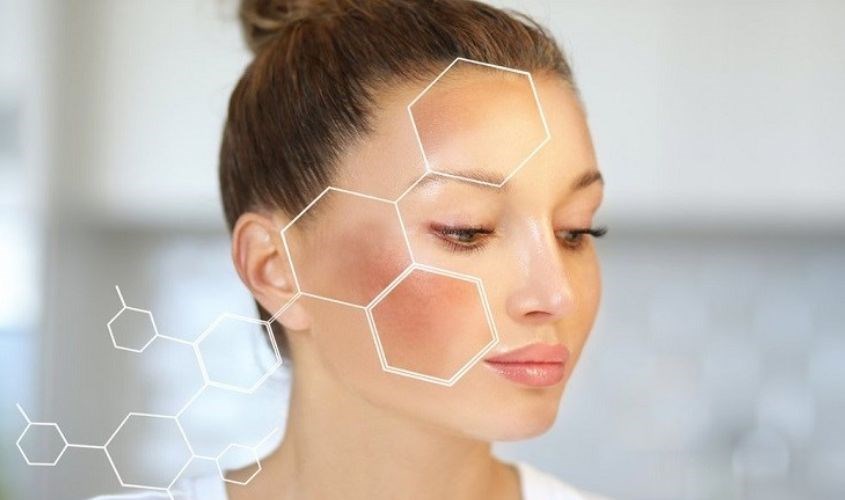 Nám da là vấn đề thường gặp ở mẹ sau sinh