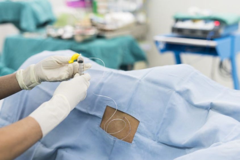 Gây tê ngoài màng cứng