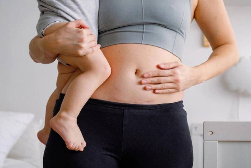 Chỉ định mổ lấy thai