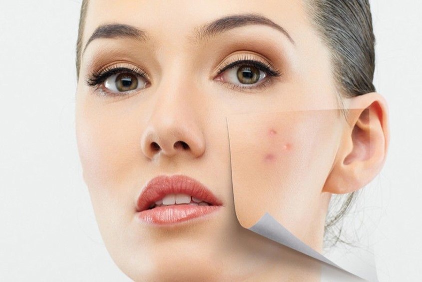 Sữa rửa mặt Acnes nổi tiếng dành cho da mụn