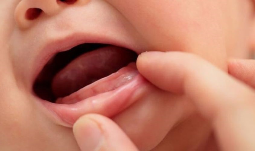 Mọc răng khiến trẻ nhát uống sữa Mọc răng khiến trẻ nhát uống sữa