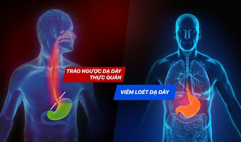 Người bị loét dạ dày và trào ngược dạ dày không nên uống chanh mật ong