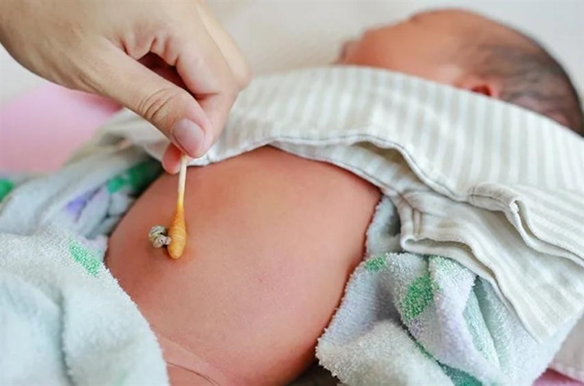 Vệ sinh rốn bị nhiễm trùng