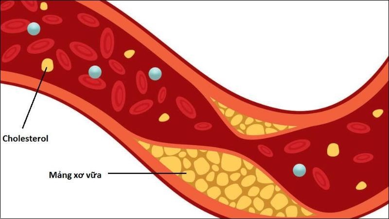 Mướp đắng giúp giảm thiểu nguy cơ mắc các bệnh tim mạch