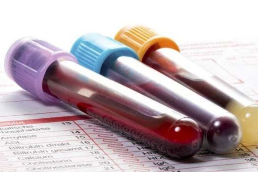 Xét nghiệm công thức máu để chẩn đoán chính xác trẻ bị kiết lỵ