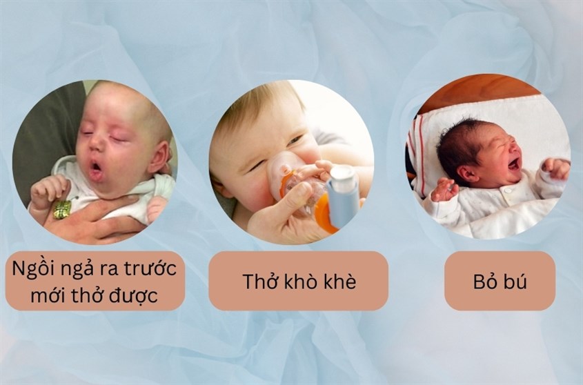 Nhịp thở của trẻ bất thường Nhịp thở của trẻ