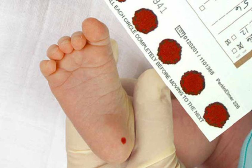 Phát hiện nhiều bệnh lý thông qua phương pháp lấy máu gót chân