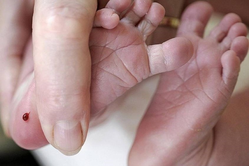 Xét nghiệm lấy máu gót chân