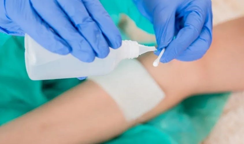 Nước muối sinh lý không có khả năng sát khuẩn