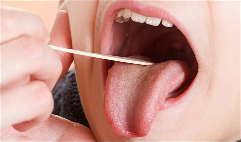 Nên cắt viêm amidan ở những trẻ trên 4 tuổi Cắt viêm amidan cho trẻ trên 4 tuổi