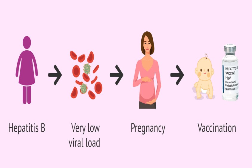 Mẹ bầu bị viêm gan B cần điều trị cho số lượng virus xuống thấp và tiêm phòng cho em bé ngay sau sinh Mẹ bầu bị viêm gan B phải làm sao?