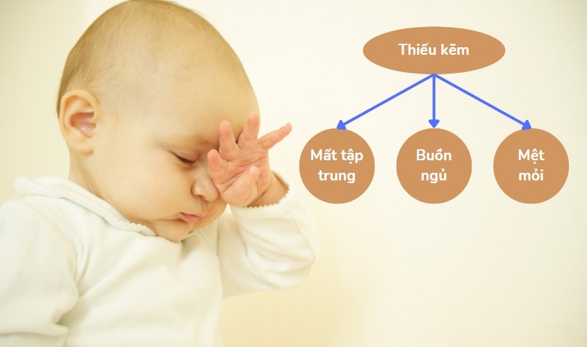 Trẻ mất tập trung là do thiếu kẻm