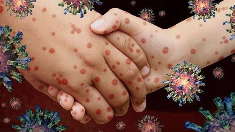 Tiêu chảy lây từ người sang người thông qua các hành động như bắt tay Tiêu chảy lây từ người sang người thông qua các hành động như bắt tay