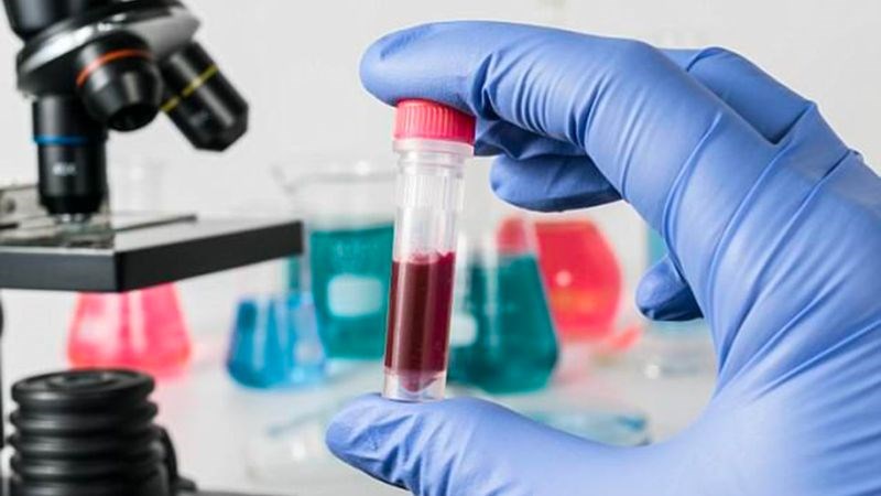 Xét nghiệm huyết thanh giúp chẩn đoán chính xác bệnh
