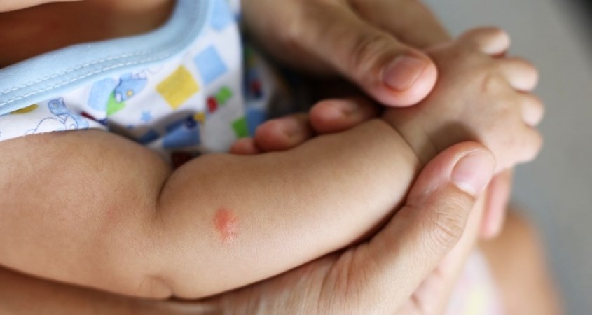 Muỗi đốt thường tạo thành những đốm nhỏ màu đỏ, hơi sưng trên da Muỗi đốt thường tạo thành những đốm nhỏ màu đỏ, hơi sưng trên da