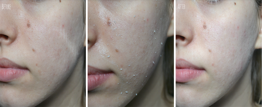 Bạn càng mát-xa sẽ mang đến cảm giác loại bỏ các bã nhờn gây hại