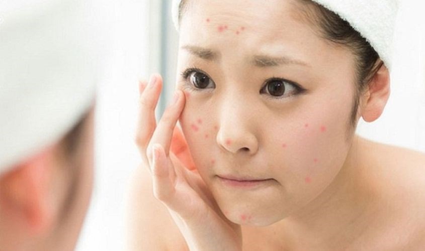 Chọn các sản phẩm không gây bít tắc lỗ chân lông