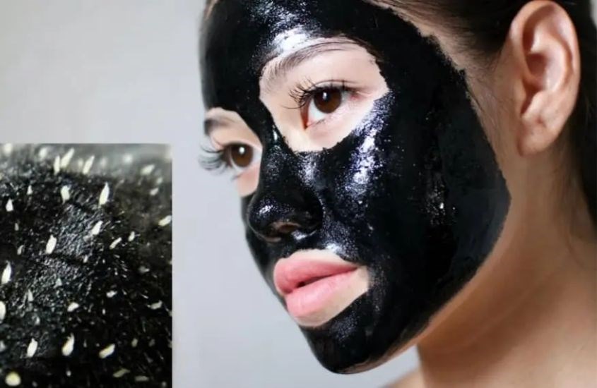 Gel lột mụn chỉ có thể loại bỏ mụn đầu trắng, mụn đầu đen, mụn bọc.