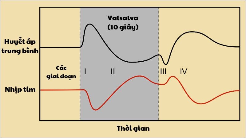 Nghiệm pháp valsalva gồm bốn giai đoạn Nghiệm pháp valsalva gồm bốn giai đoạn có sự dao động của huyết áp và nhịp tim