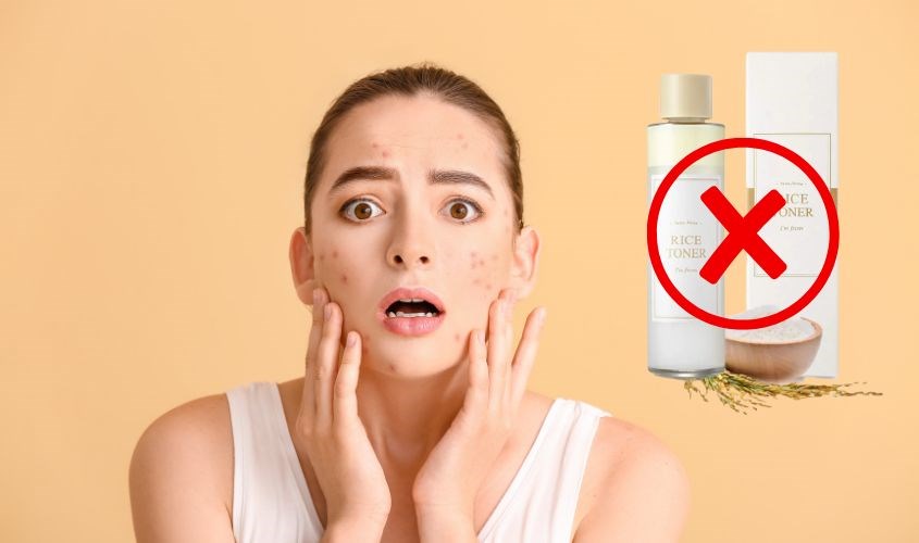 Làn da bị dị ứng với đậu nành, sữa, trứng thì không nên sử dụng toner I