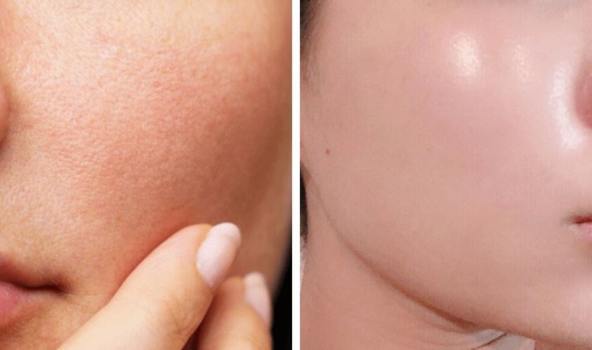 Ưu điểm của sản phẩm