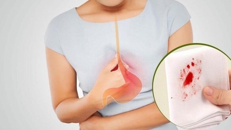 Nôn ra máu là triệu chứng hay gặp ở giai đoạn sau của ung thư dạ dày