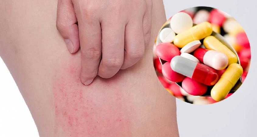 Điều trị dị ứng yến mạch