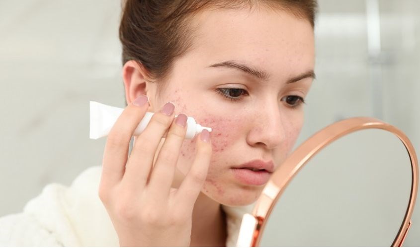 Dùng sản phẩm đặc trị cho da