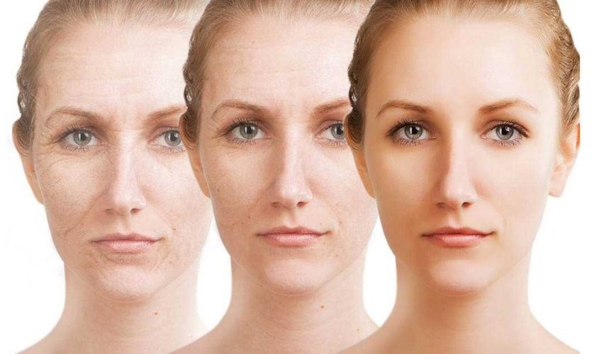 Kem dưỡng trắng giúp ngăn ngừa tình trạng lão hóa da