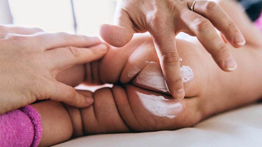 Sử dụng xịt kháng khuẩn hoặc bôi kem chống hăm khi thay bỉm