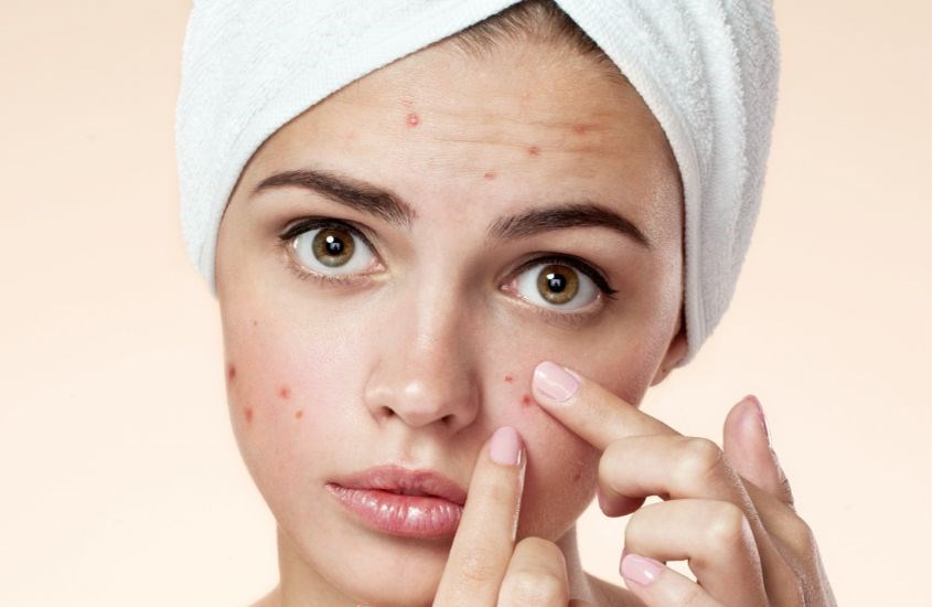 Nước muối sinh lý giúp giảm sưng viêm, giảm ngứa và giảm mụn Nước muối sinh lý giúp giảm sưng viêm, giảm ngứa và giảm mụn