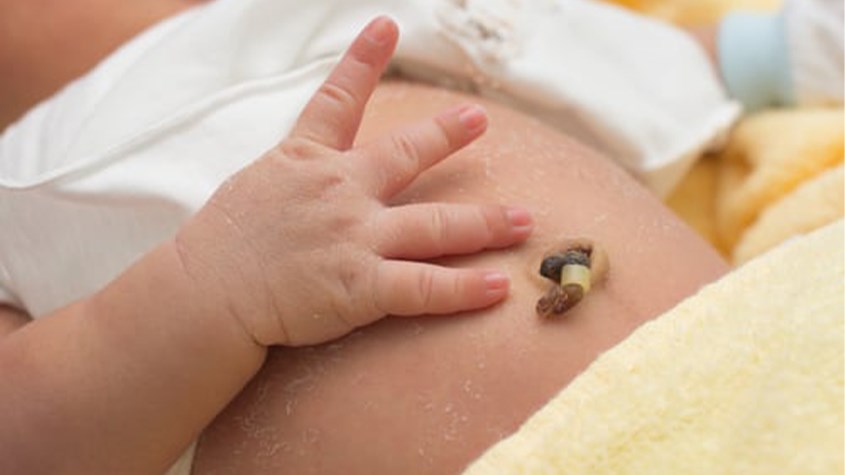 Cách chăm sóc rốn cho trẻ sơ sinh sau khi tắm