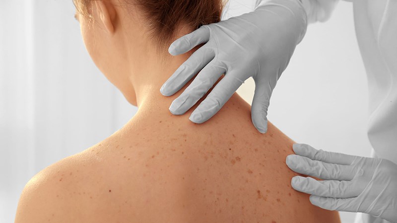 Bác sĩ sẽ chẩn đoán dựa trên các triệu chứng hiện có của bệnh nhân