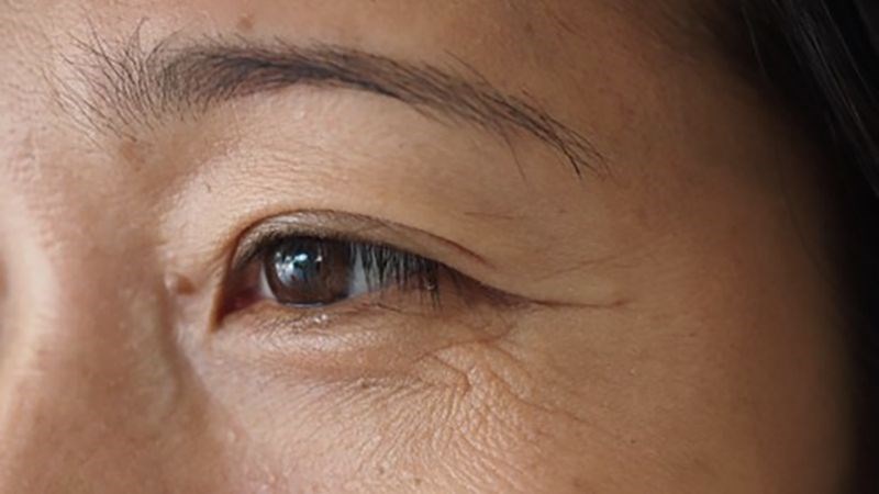 Nếu bạn cần một dược liệu để giảm nếp nhăn thì dầu mù u là một sự lựa chọn tốt