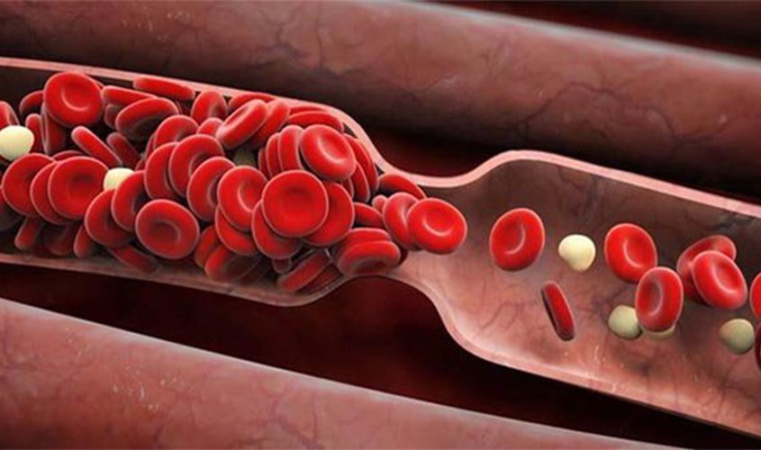 Nếu các mẹ đeo đai nịt bụng ngay sau khi sinh sẽ gây cản trở lưu thông máu