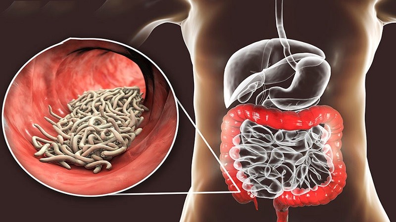 6 bệnh lây qua đường tiêu hoá phổ biến và các nguyên nhân điển hình