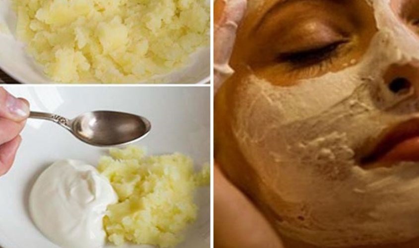 Mặt nạ khoai tây sữa chua cùng dầu dừa