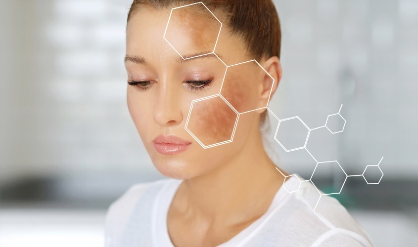 Cải thiện sắc tố da