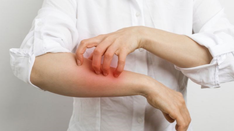 Một số người có thể dị ứng với hạt hướng dương