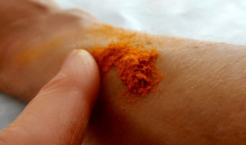 Bột nghệ hỗ trợ làm lành vết thương