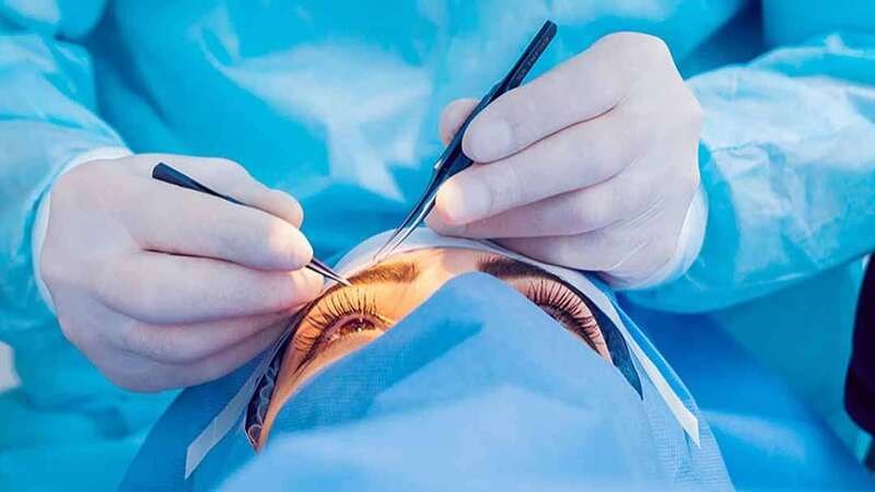 Phẫu thuật tăng nhãn áp xâm lấn tối thiểu rất tiên tiến[
