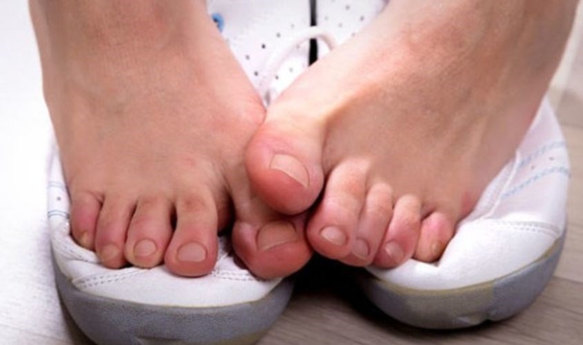Chân bị hôi vì mang giày thường xuyên