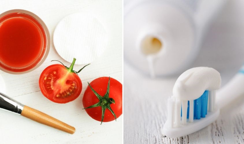 Trị hôi chân với kem đánh răng và cà chua