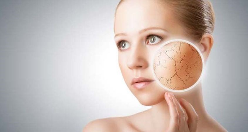 Không phù hợp với loại da khô hoặc da hỗn hợp thiên khô