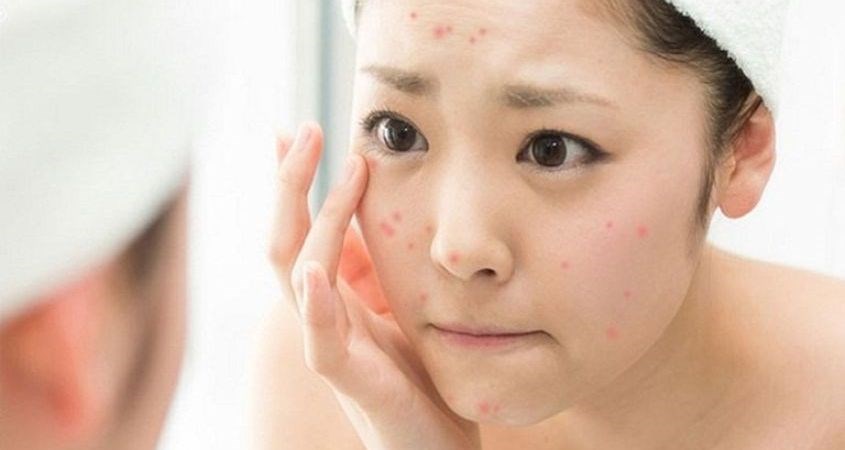 sữa rửa mặt Vichy Normaderm Anti-Imperfection da dầu, mụn, hỗn hợp