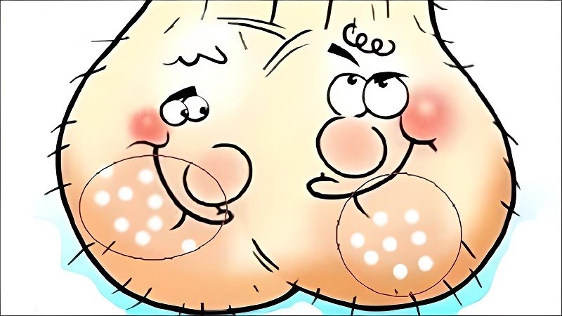 Bệnh nhiễm trùng lây truyền qua đường tình dục có thể gây ra mụn tinh hoàn Bệnh nhiễm trùng lây truyền qua đường tình dục có thể gây ra mụn tinh hoàn